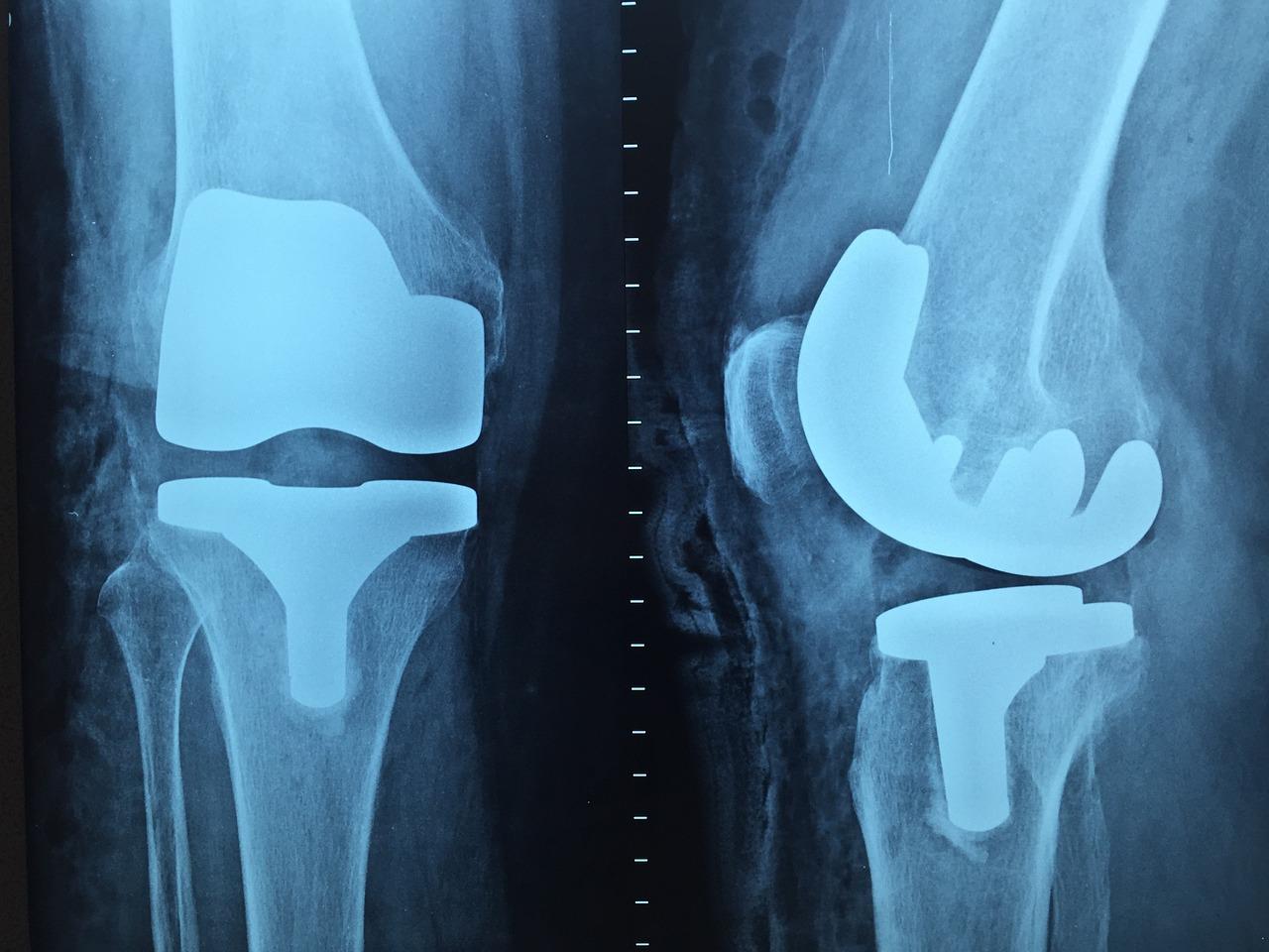 Orthopedie in Tilburg
